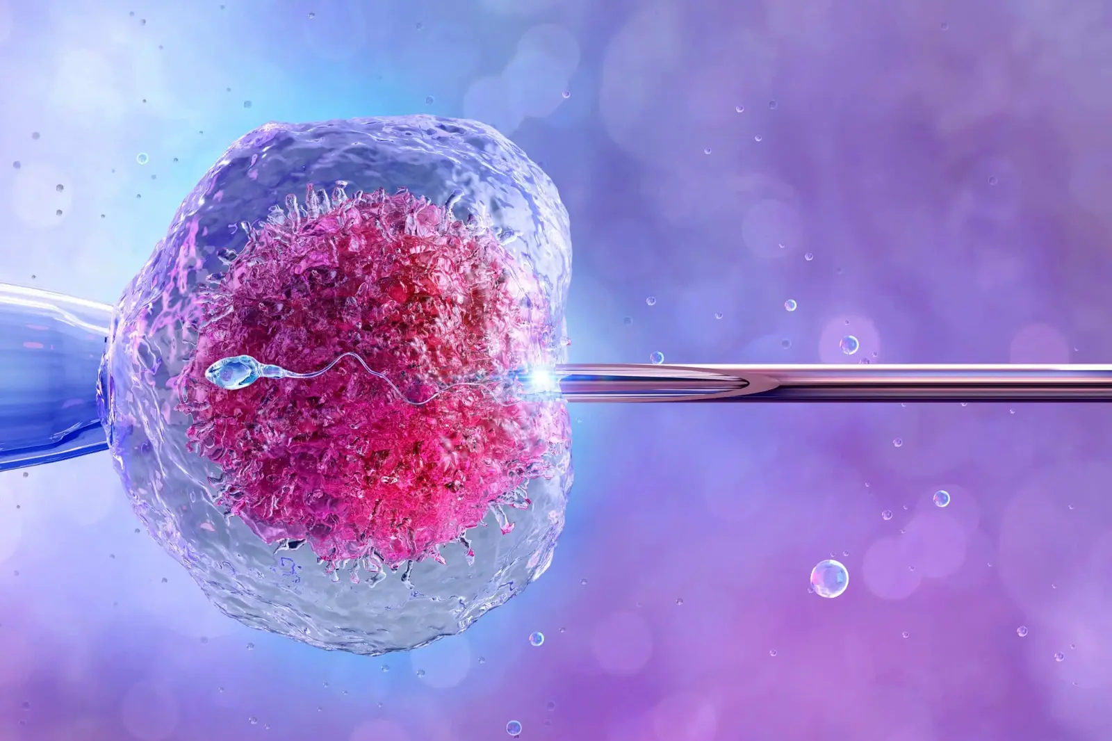 IVF jako součást plánované léčebné cesty